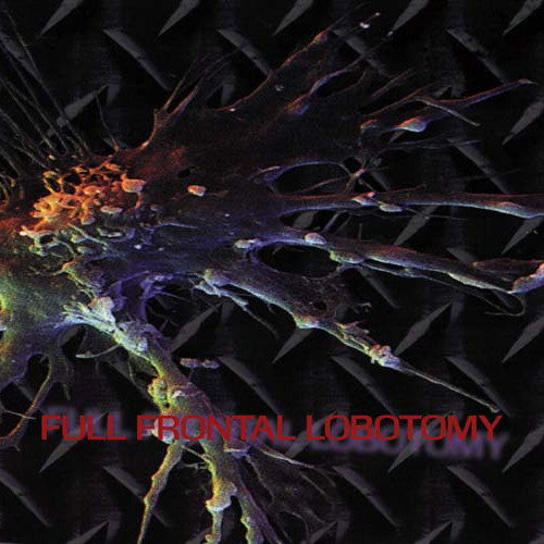 Full Frontal Lobotomy